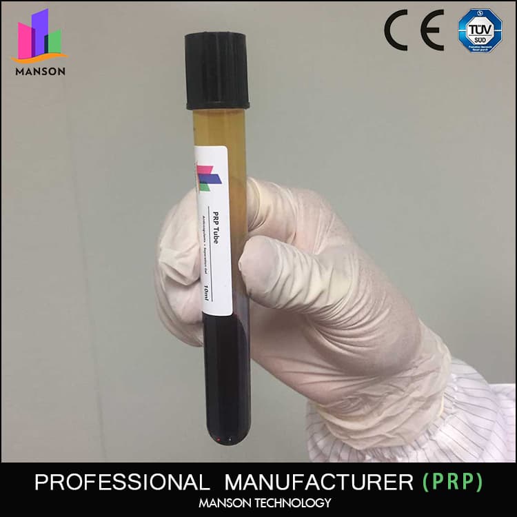 platelet rich plasma prp tube
